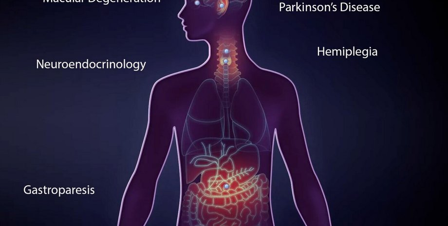 Импланты в теле человека