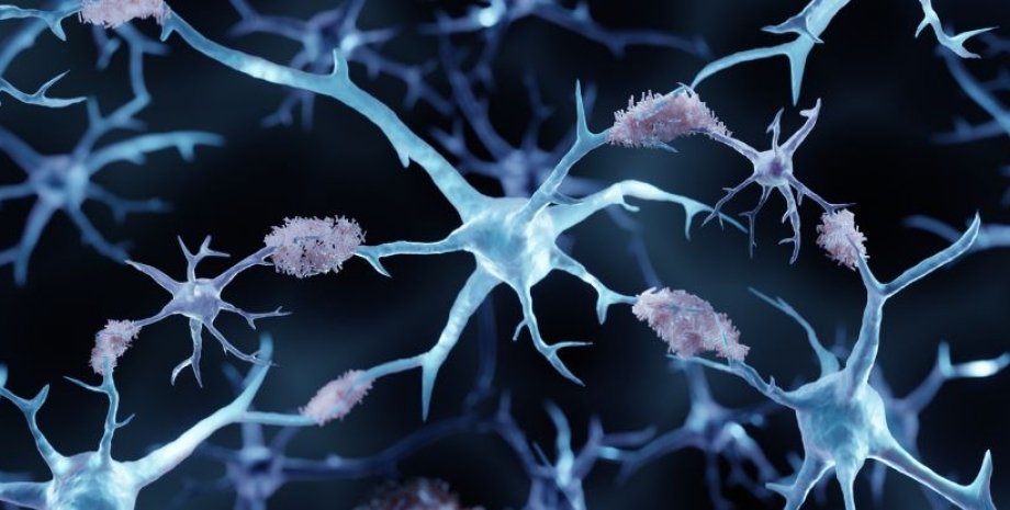 нейрони, мозок, бета-амілоїд