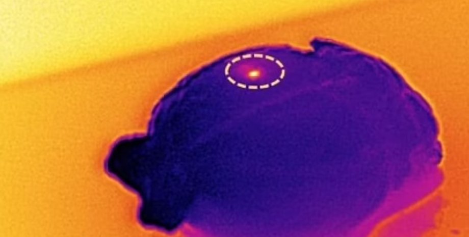 имплантат, мозг