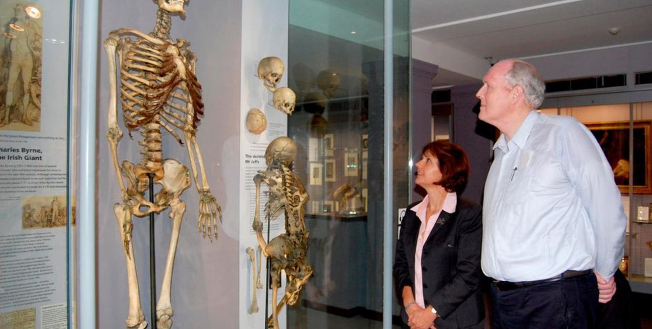 Чарльз Бирн, рисунок, музей, скелет, экспонат, Британия, ирландский великан