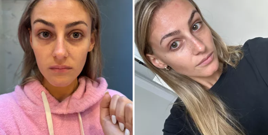 Почему стоит отказаться от сахара, диета, правильное питание, еды, эксперименты, США, внешность, красота