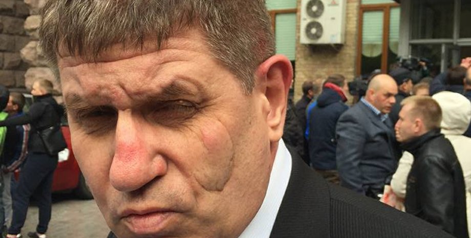 Депутат Киевсовета Олег Гелевей, побитый неизвестными / Фото: Facebook