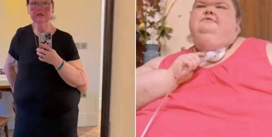 Схуднення на 200 кілограмів, операціє зі зменшення шлунку, дієта, фото до та після схуднення, Велика Британія, тренди TikTok