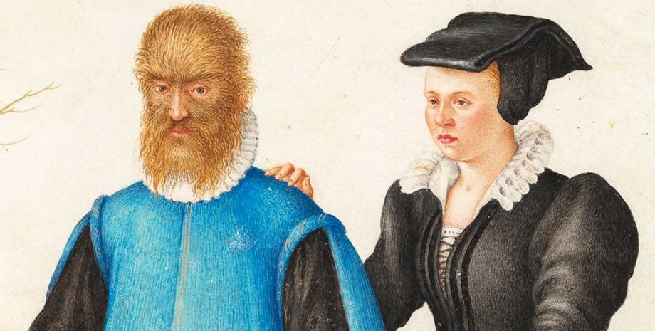 Красавица и чудовище, Петрус Гонсалвус