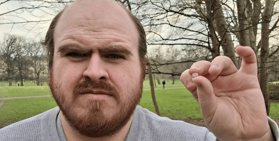 Мужчина прожил 20 лет с деталью от конструктора в ухе, что он чувствовал, интересные истории, странные случаи из жизни