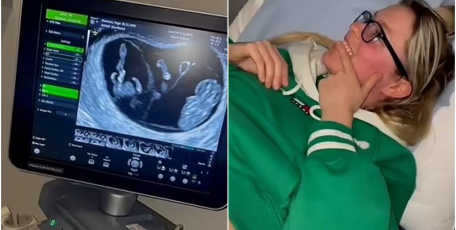 Женщина, которая лечилась от бесплодия, родила идентичных тройняшек, как это возможно, подробности удивительной истории