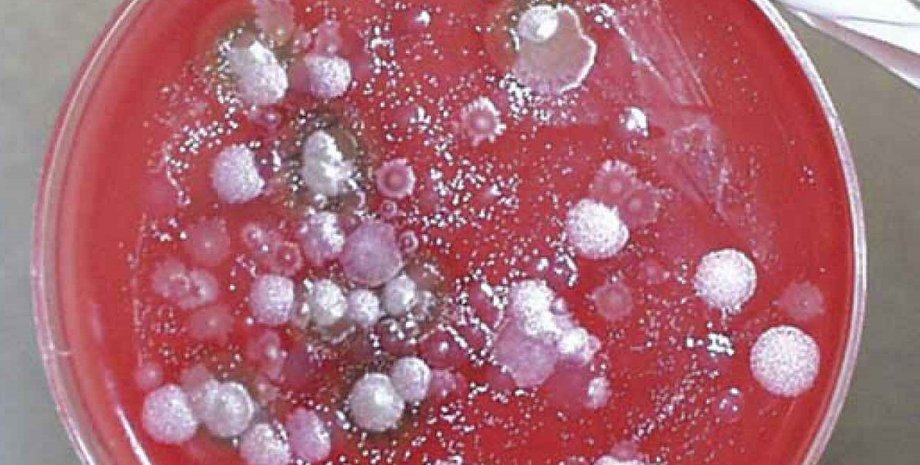 Споры сибирской язвы / Фото: imgkid.com