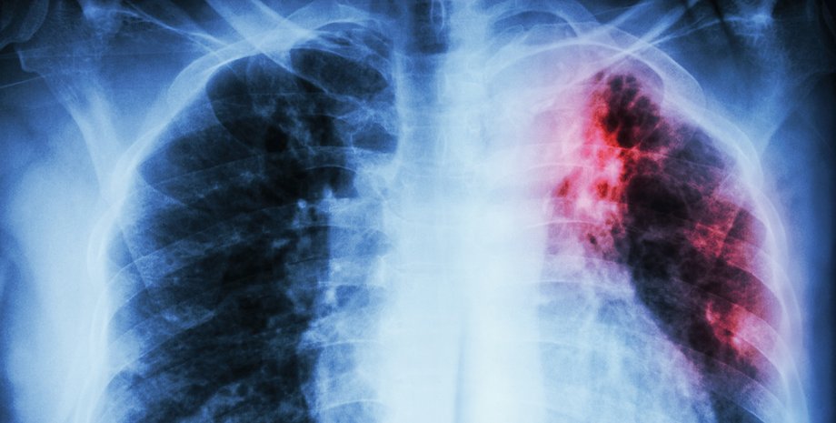 Фото: Getty Images