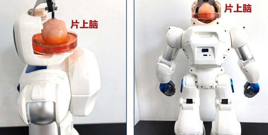 Робот, мозг, стволовые клетки, фото