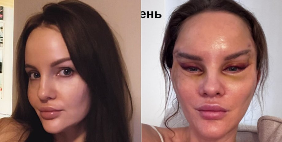 До и после операции