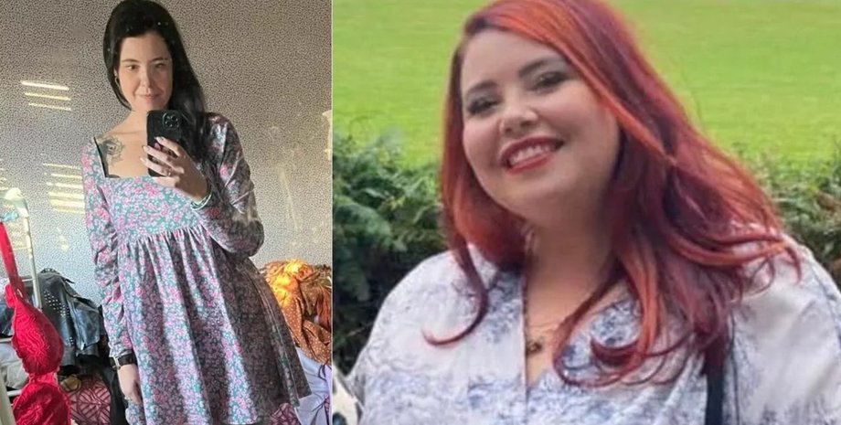 Жінка скинула 63 кг завдяки TikTok, схуднення, операція, зайва вага, скинула зайву вагу, об'їдалася шоколадом, потрапила в пастку