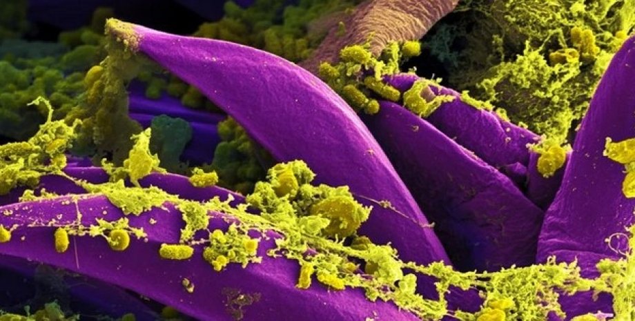 Бактерии бубонной чумы