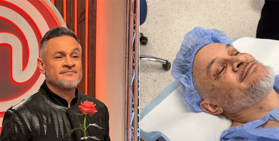 Ектор Хіменес-Браво зробив операцію на повіках