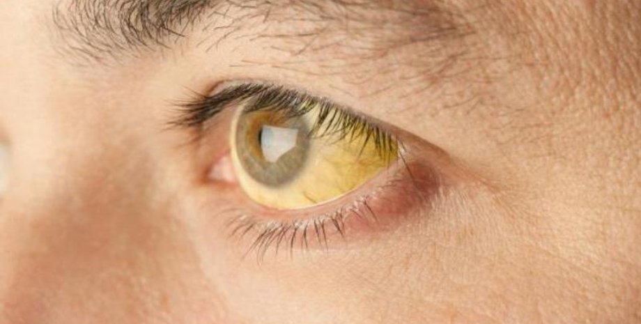 Фото: 101parazit.com