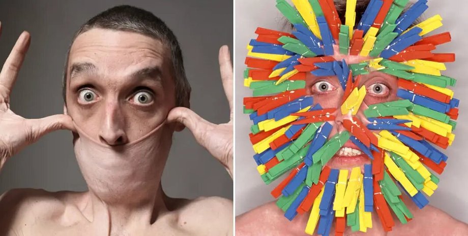 новости мира, гарри тернер, мужчина с самой эластичной кожей, книга рекордов гиннеса