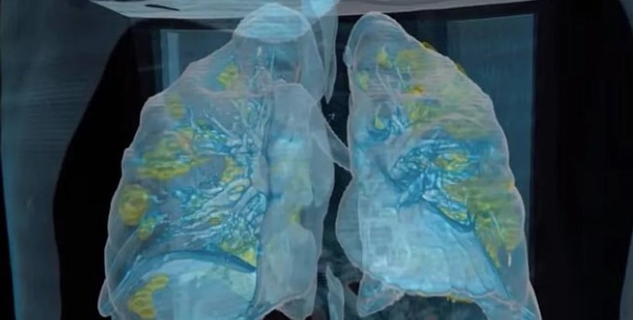 Фото: George Washington University Hospital