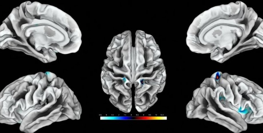 Мозок, ділянки мозку, клітор, жіночі геніталії