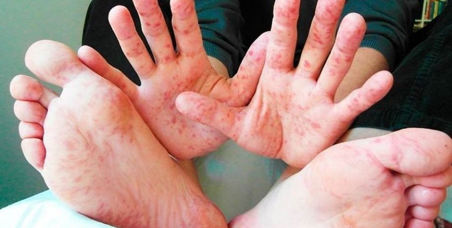 Фото: Etcetera.media