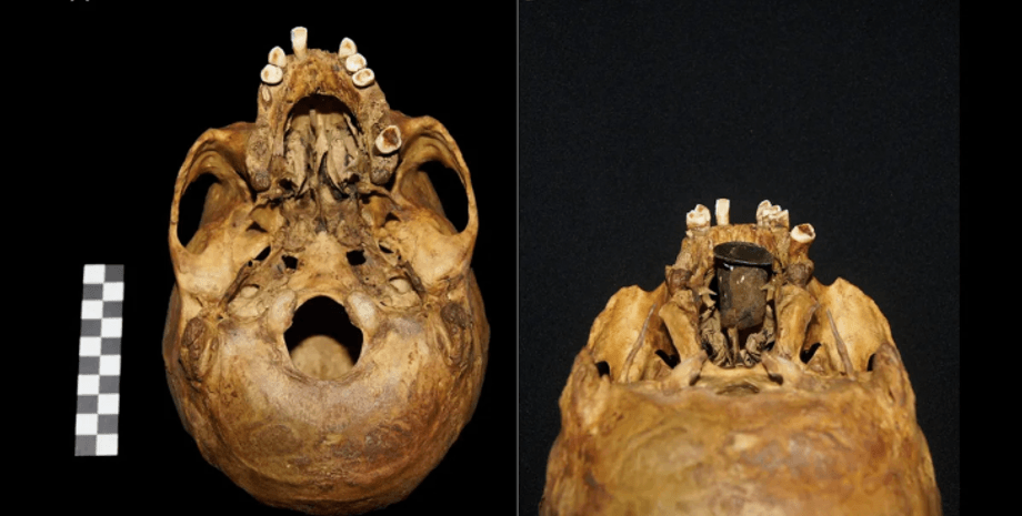 археологи, археология, раскопки, Краков, Польша, небо, протез, болезнь, развитие, находка, устройство, рот, носовая полость, язык, пища, открытие, металл, шерсть, пластина