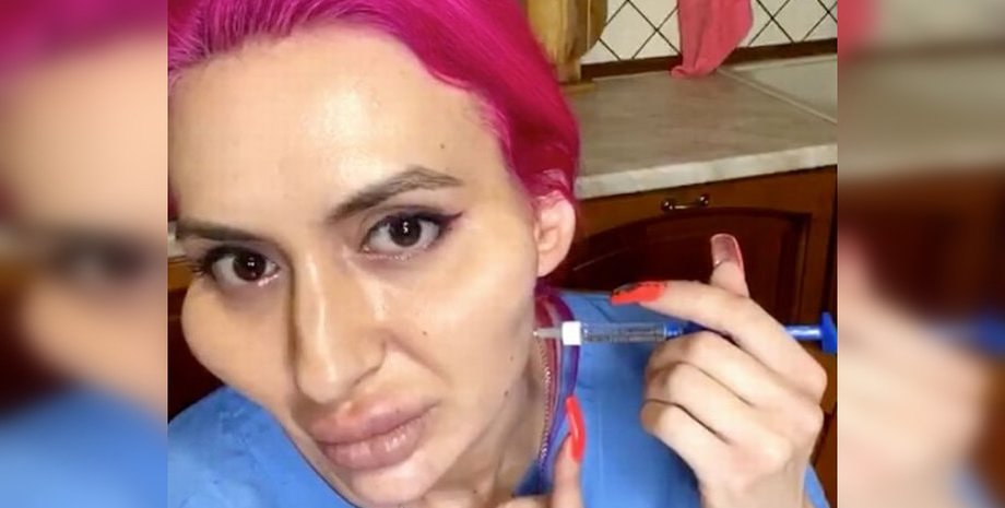 Анастасия Покрещук, щеки, укол, филлер, фото