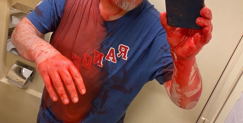 Дмитрий Муратов, нападение на журналиста