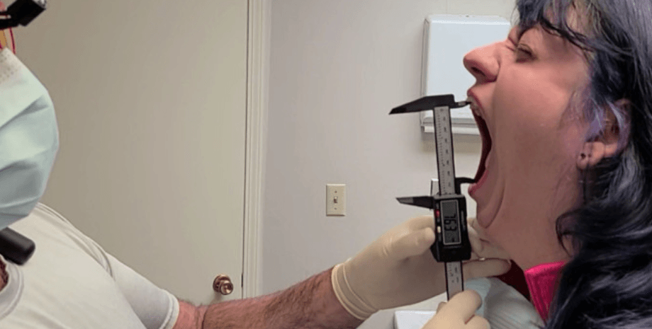 Книга рекордов Гиннеса, достижения, титул, женщина с самым большим ртом на планете, интересности