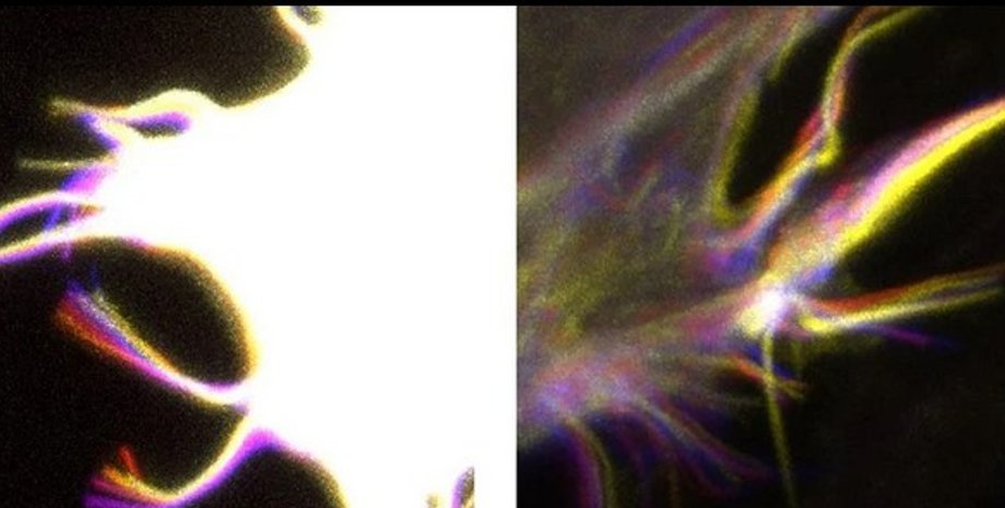 Филоподии, клетки