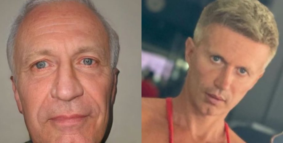 Пластическая операция, до и после, мужчина изменился до неузнаваемости, помолодел на 40 лет, подтяжка лица, ринопластика