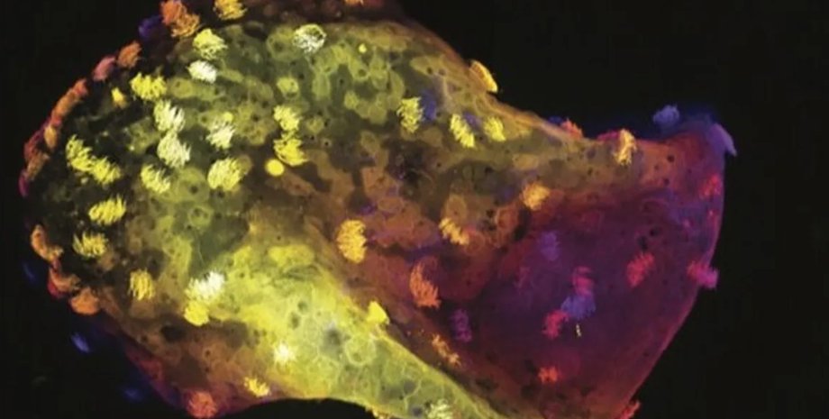 нейробот нейробот