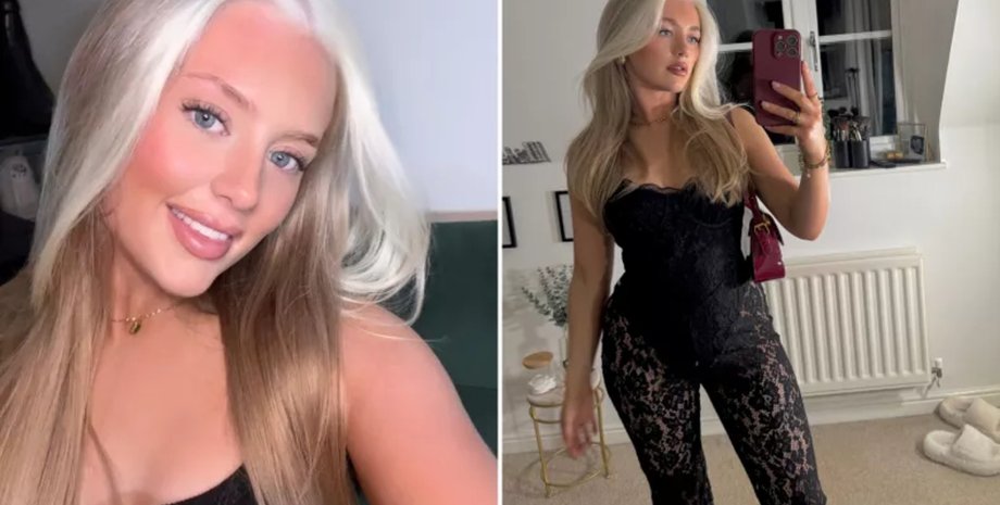 Женщина родилась с белой прядью в волосах и с годами узнала о редком заболевании