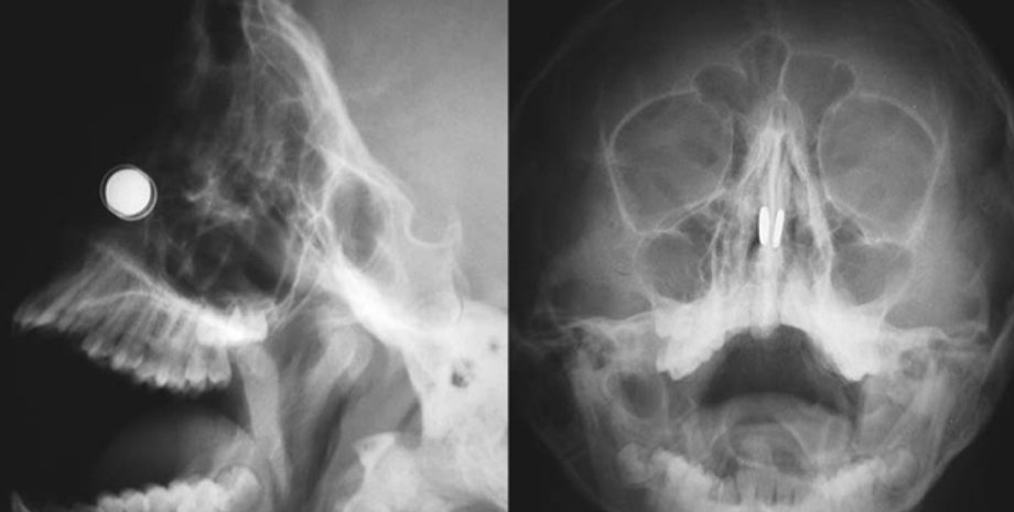 Фото: The New England Journal of Medicine