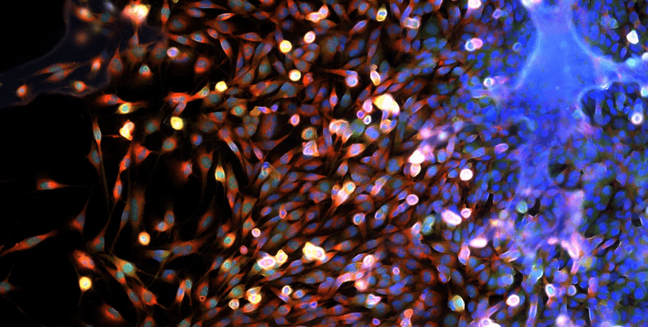 рак, клетки, клетки рака