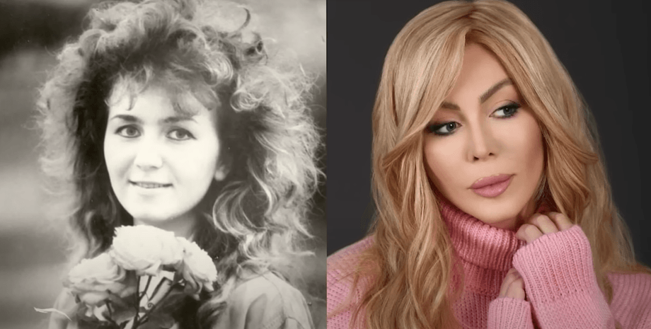 пластические операции Ирины Билык