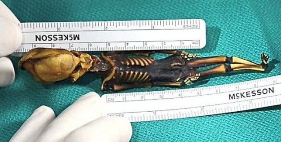Скелет, ученный, руки, исследование, размер, линейка