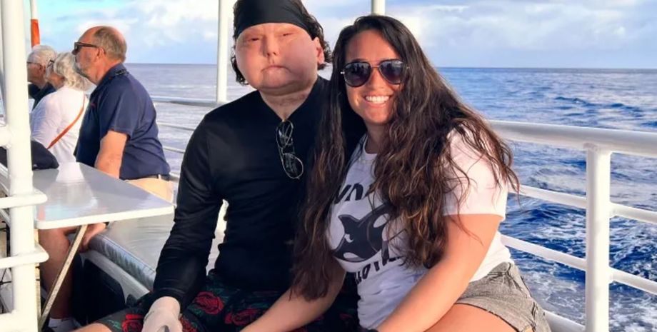 Джо ДиМео, первый в мире человек с полностью пересаженным лицом, операция, авария