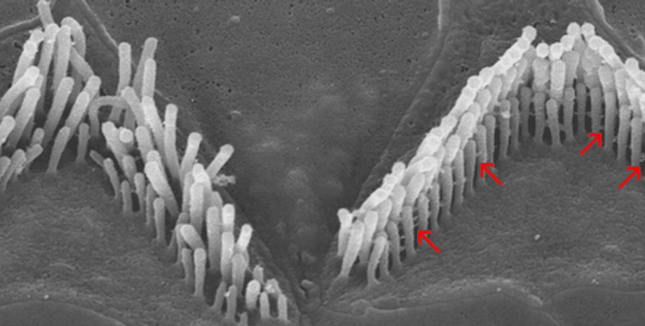 глухота та лікування