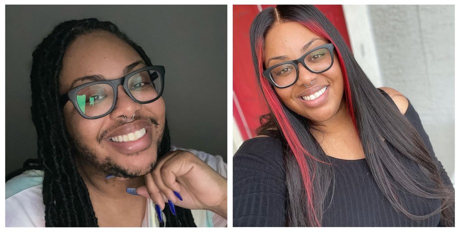 девушка с бородой, гирсутизм, растительность