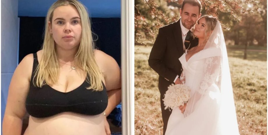 Как похудеть к лету, диеты, операция на желудке, рацион, питание, похудение до и после, фото, Великобритания