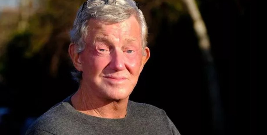 4 года не мог закрыть глаза, проблемы с глазами, неудачная операция, пережил несколько операций, пластика лица, не мог спать, ринопластика