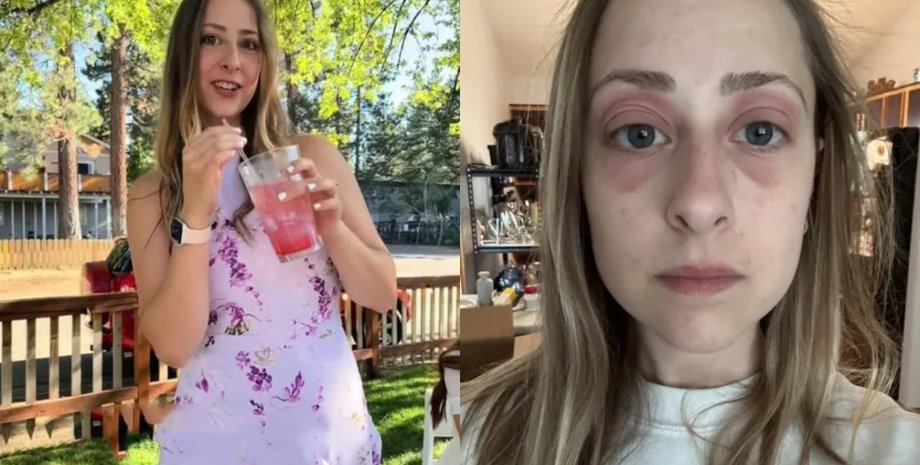 Девушку "убивало" ее собственное жилье: она это поняла через собственные селфи