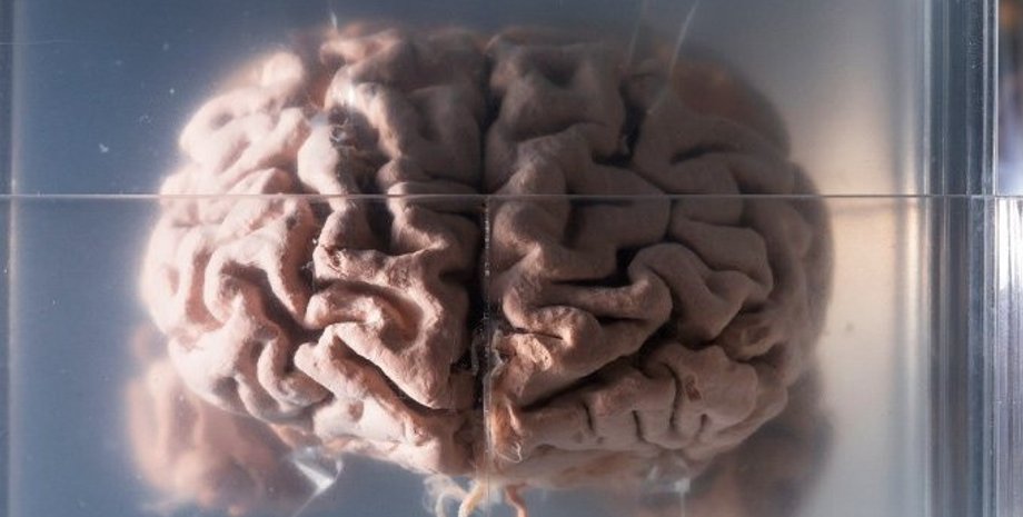 мозг человека, человеческий мозг