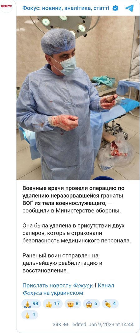 Украинские хирурги извлекли неразорвавшийся боеприпас