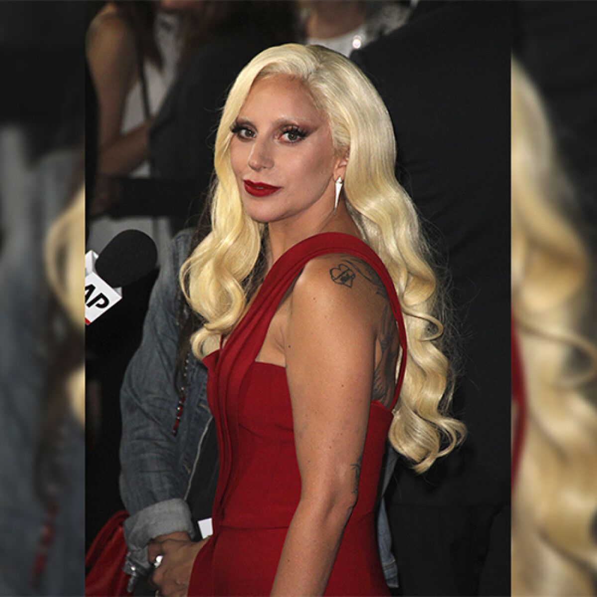 Проклятье красной волчанки. 6 знаменитостей, страдающих