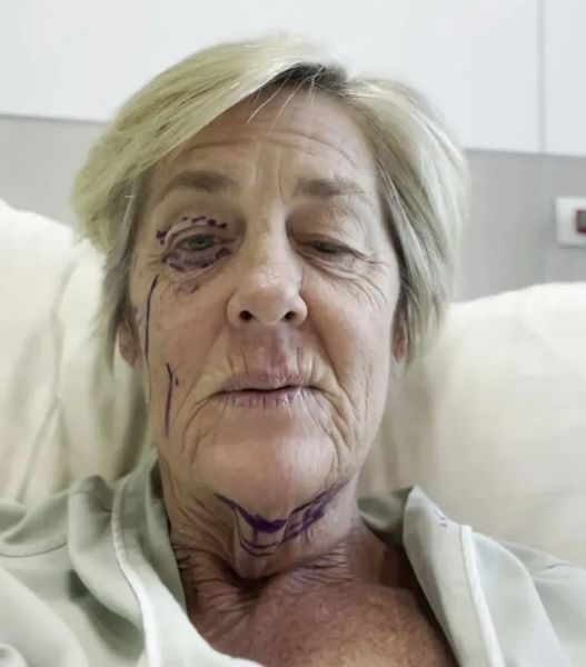 Как сохранить молодость, омоложение, красота, внешность, до и после пластической операции