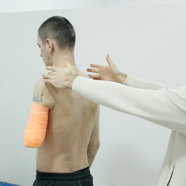 ампутация, протезирование, война