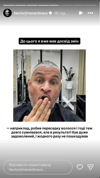 Ектор Хіменес-Браво делал пересадку волос