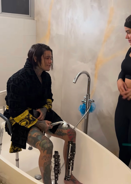 Увеличение роста, сложные операции, фото до и после, аномалии, блогер, Колумбия, фото до и после