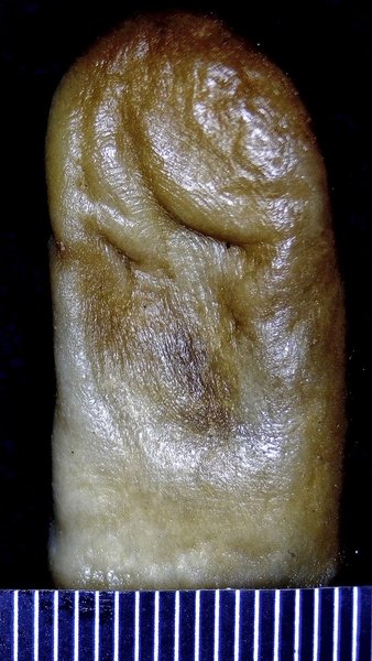 Дактилоскопические отпечатки, идентификация тел погибших защитников Украины, идентификация репатриированных тел по ДНК, идентификация тест ДНК, ДНК-тест, ДНК-тест надежность, судебно-медицинская криминалистика, идентификация тел погибших воинов ВСУ, постановление об опознании, дактилоскопическая идентификация, генетический материал для сравнения, генетический материал для опознания, Репатриированные тела бойцов ВСУ