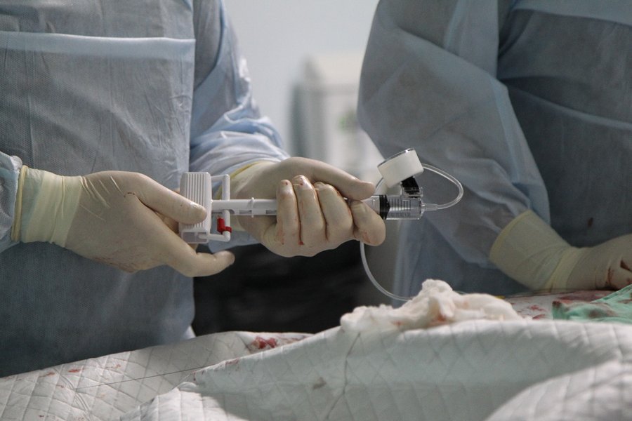 катетер, операция на сердце, кардиохирургия