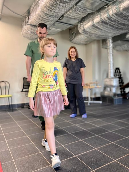 протез ноги, протезирование, детский протез, ампутировали ногу, ампутация, охматдит, протез, протезирование ребенка, Косметический протез